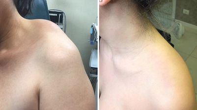 Bone Therapy Cream Pack of 2 - REYNIXX