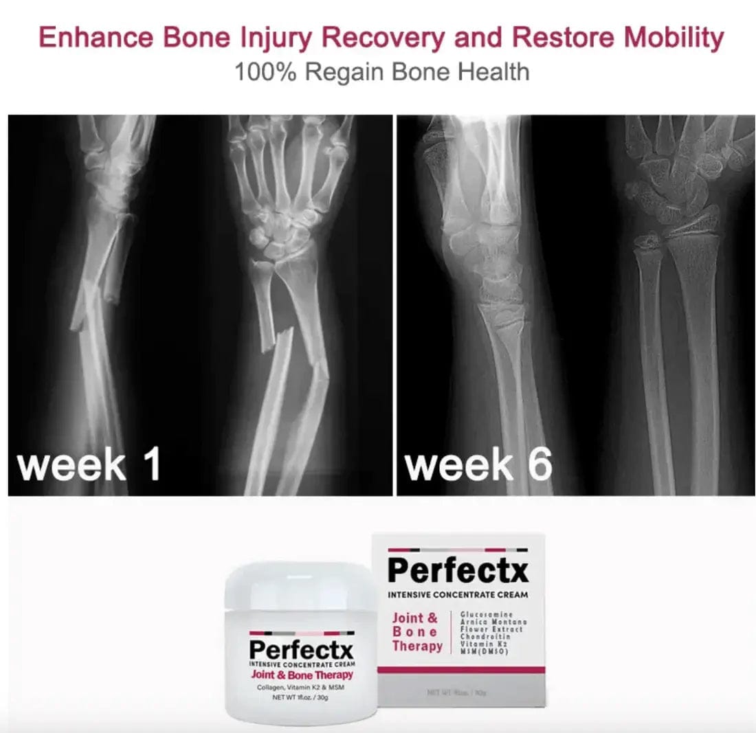 Bone Therapy Cream Pack of 2 - REYNIXX
