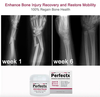 Bone Therapy Cream Pack of 2 - REYNIXX